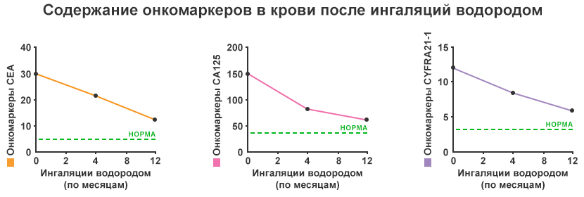 Метастазы в мозг при раке легкого