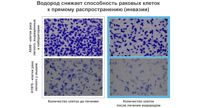 Рак легкого