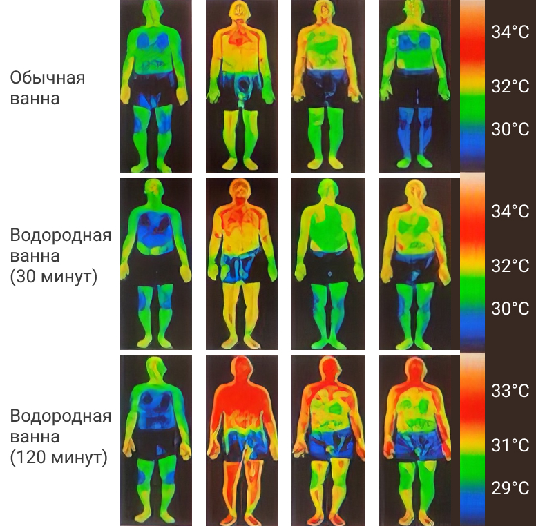Водородные ванны повышают кровообращение