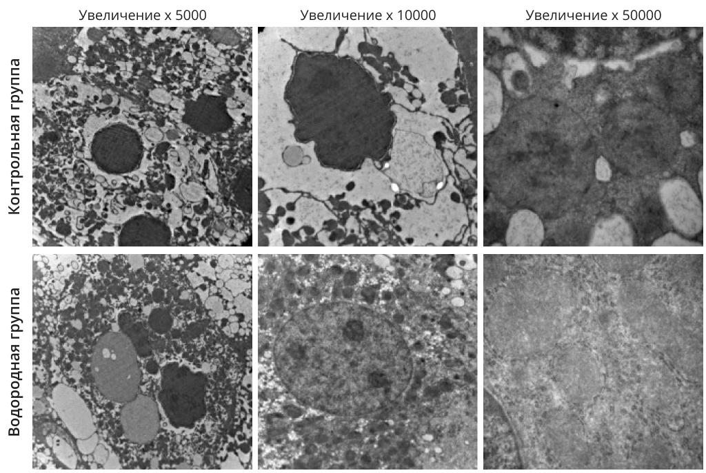 Гепатотоксичность