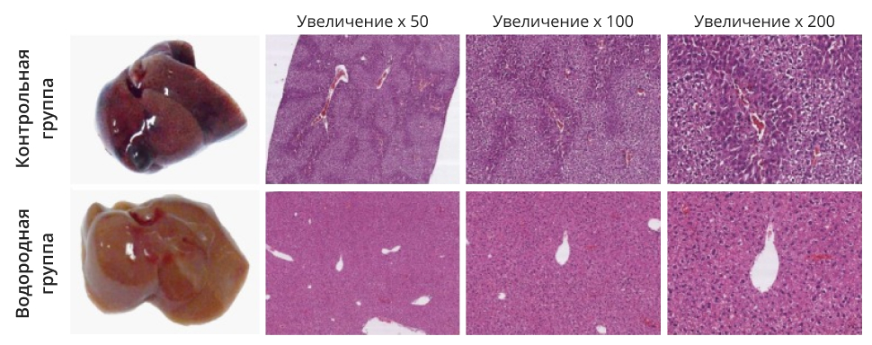 Гепатотоксичность