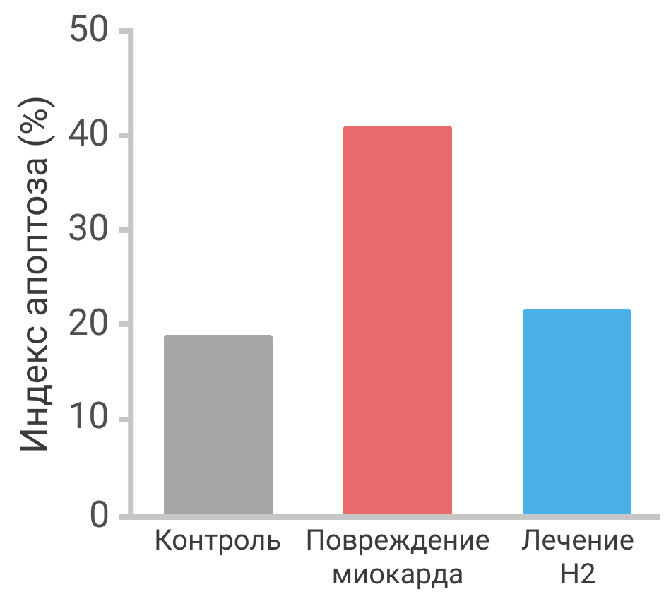 Повреждение миокарда