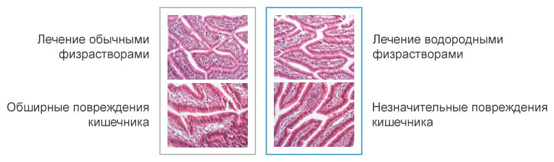 Повреждения кишечника