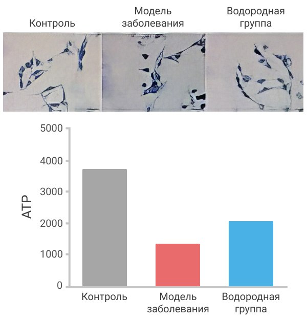 Защитный эффект на нейроны спинного мозга